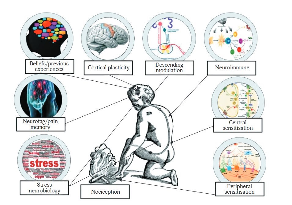 what-is-the-definition-of-pain-chronic-pain-treatment-belfast